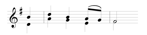 Tetherdown